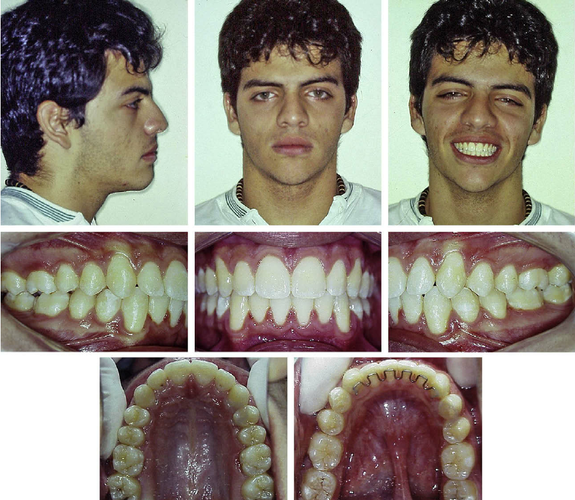 Posttreatment photographs