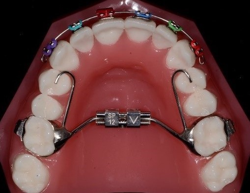 www.bachmayerorthodontics.com.au