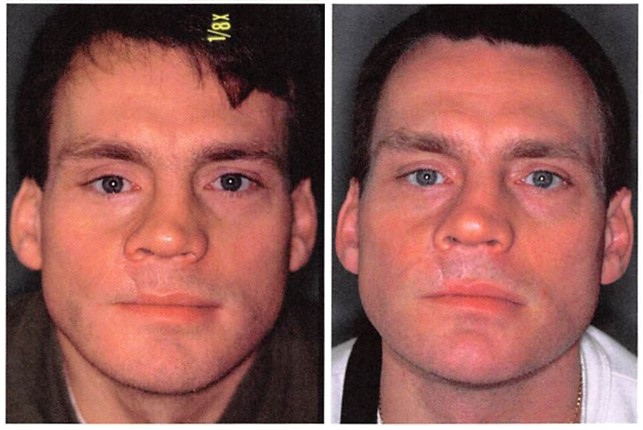 facial5.jpg