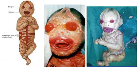 biomedres-openaccess-journal-bjstr.ID.005547.G003.png