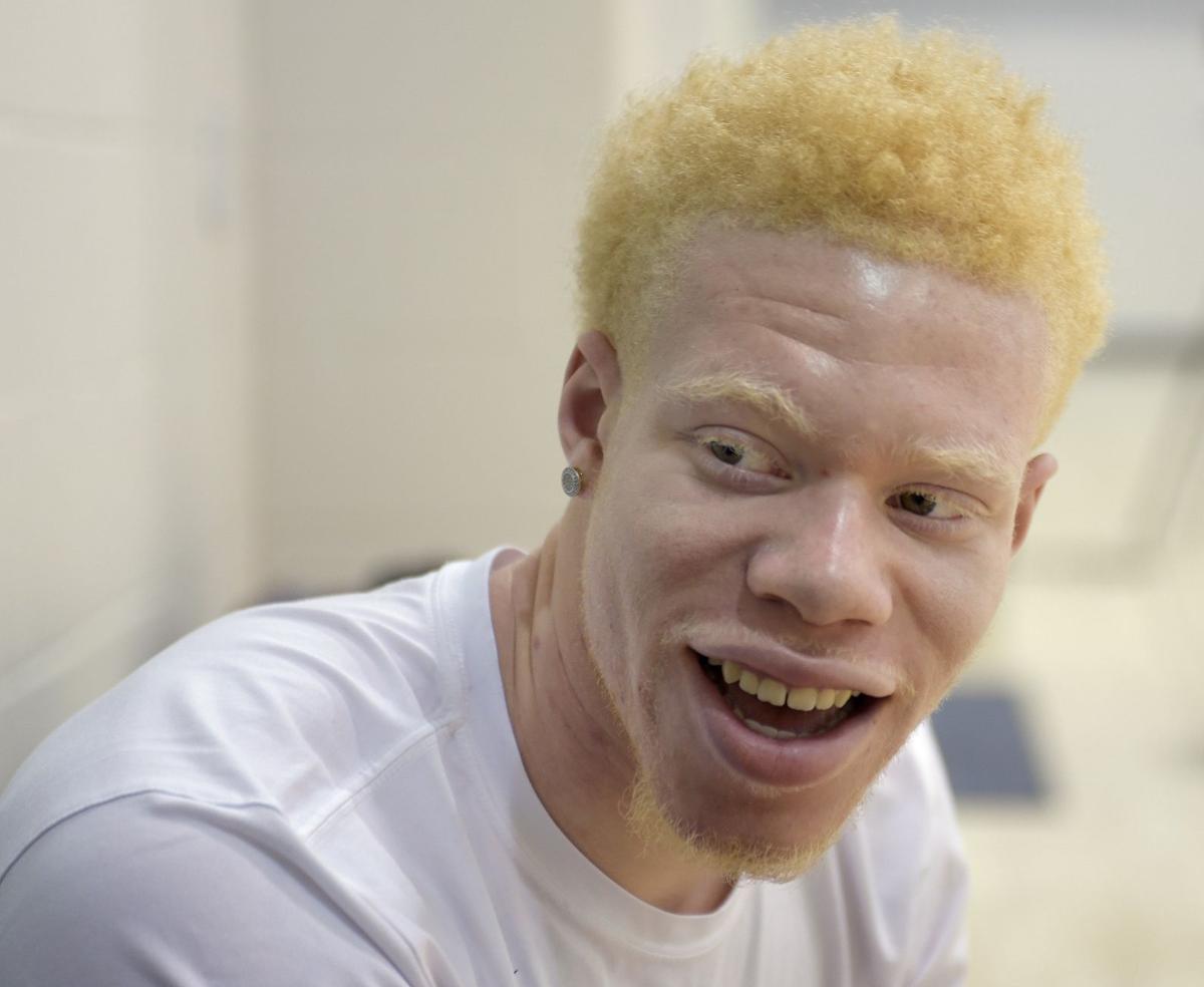 Von is an albino black man??? 😳😳😳 : Voleman