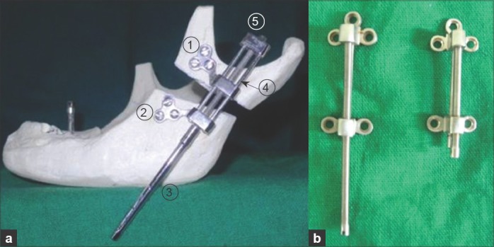 (a) Distractor for vertical ramus lengthening, (b ...