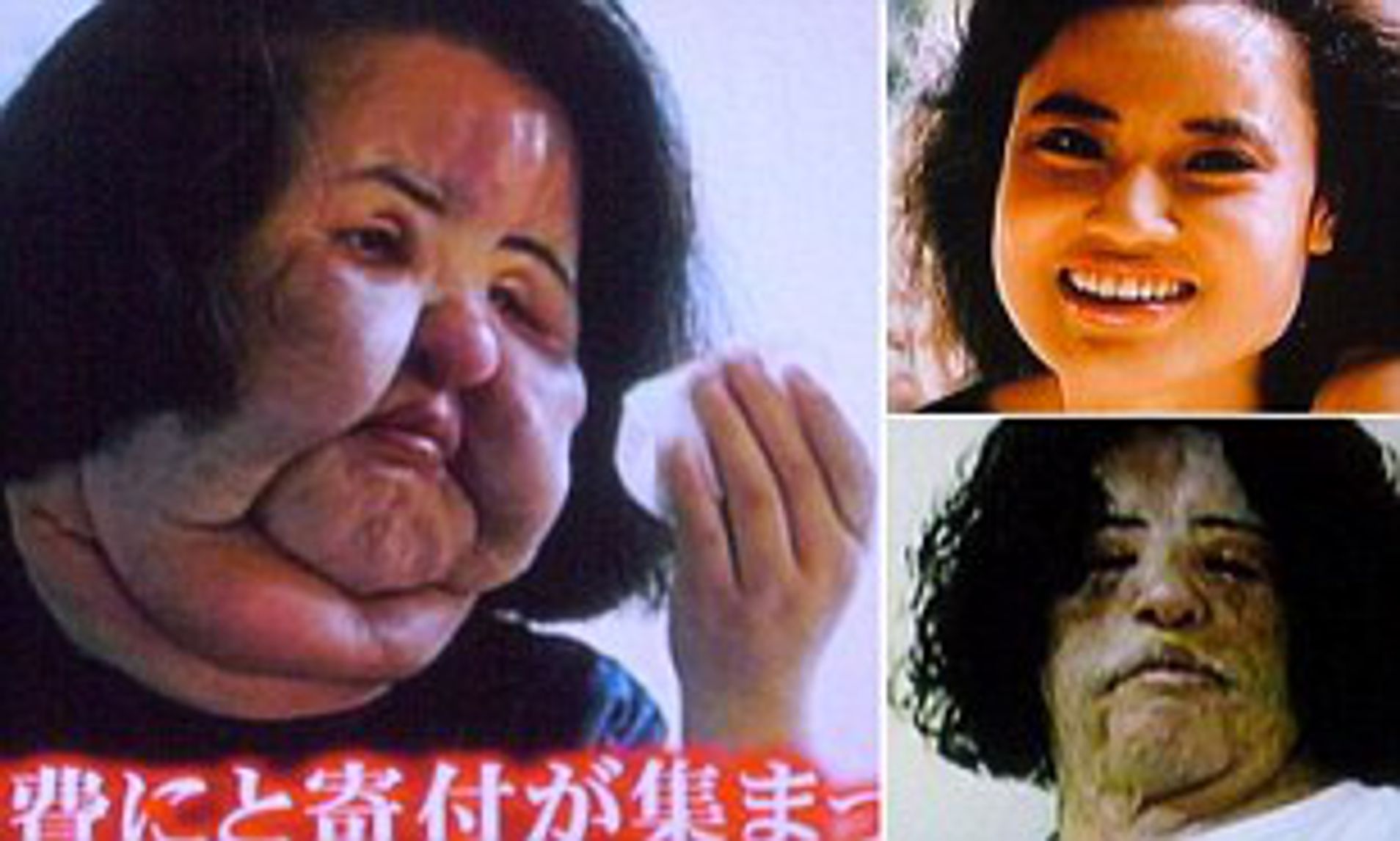 Korean woman Hang Mioku injects COOKING OIL into her own face after being  refused more plastic surgery | Daily Mail Online