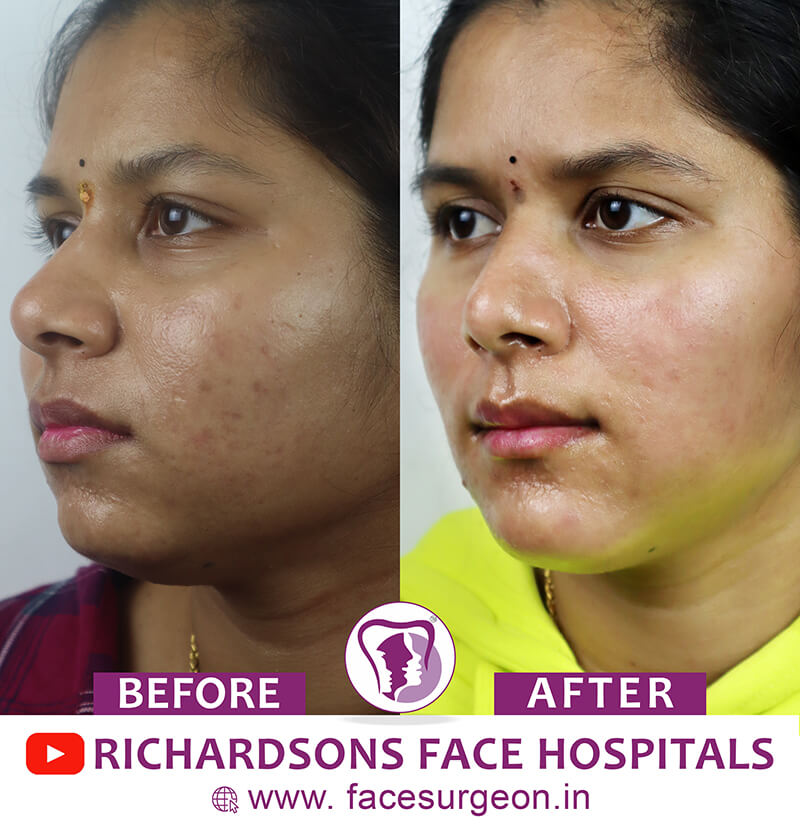facesurgeon.in