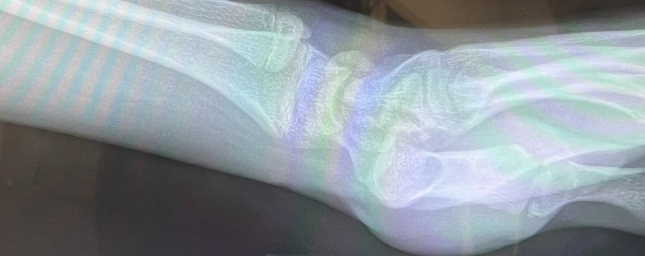 6665039_wrist_3.webp