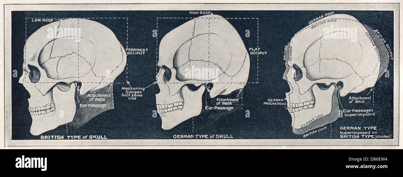 comparison-of-british-german-skull-shapes-ww1-D86EW4.jpg