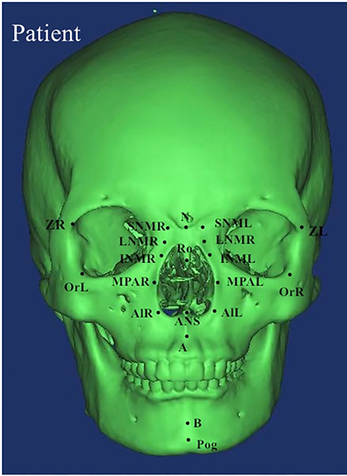 1751056883856