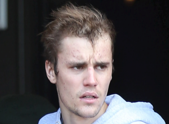 896209631_JustinHairline.png.e045b510db3b3456a791872816b5fbee.png