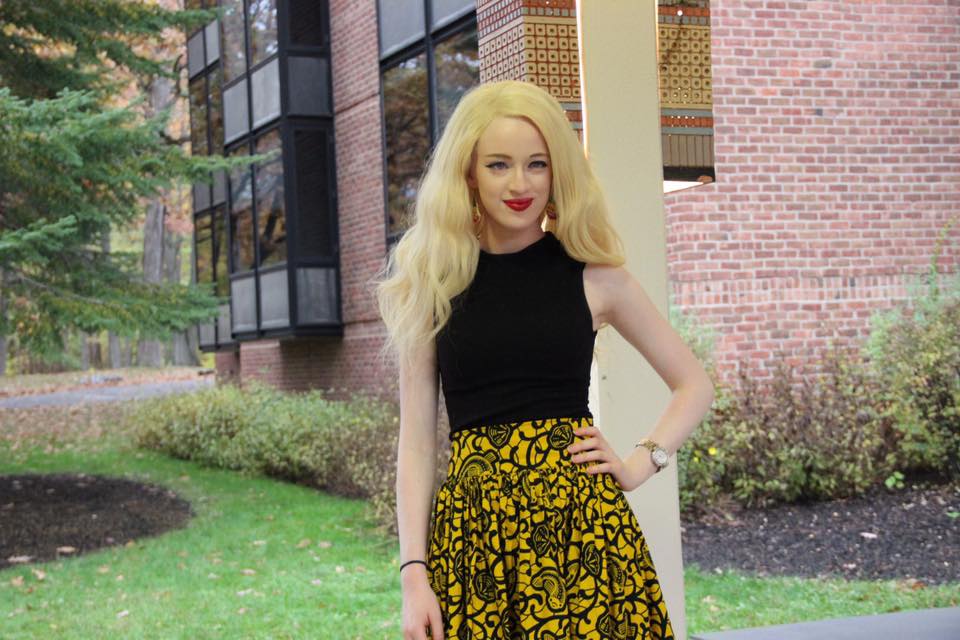 Meron Benti, an Ethiopian albino: «I know people stare at me. In ...