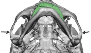wide-posterior-zygomatic-arches-3D-CT-scan-inferior-view-Dr-Barry-Eppley-Indianapolis-300x177.jpg
