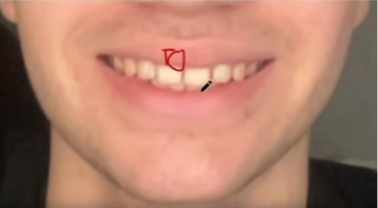 1783777171428