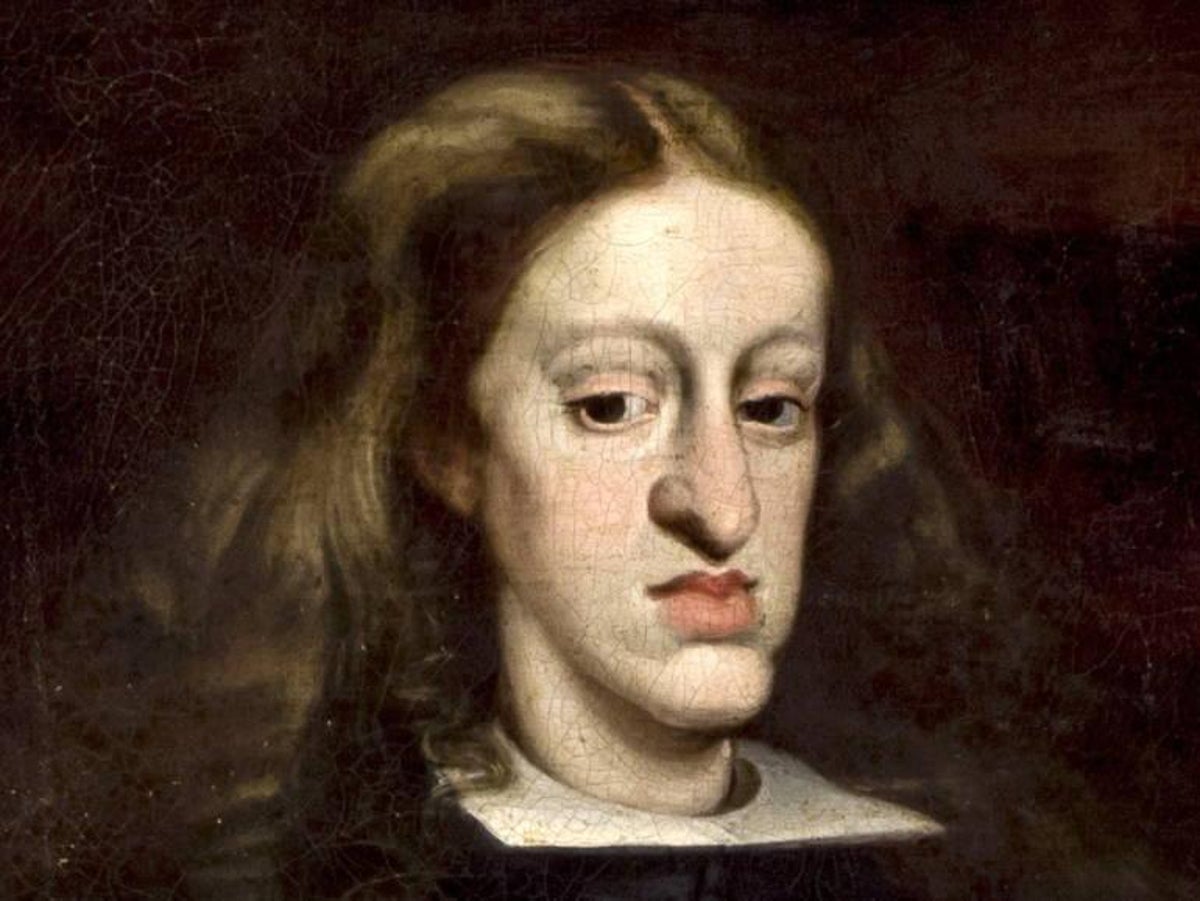 habsburg-jaw-of-charles-ii.jpg