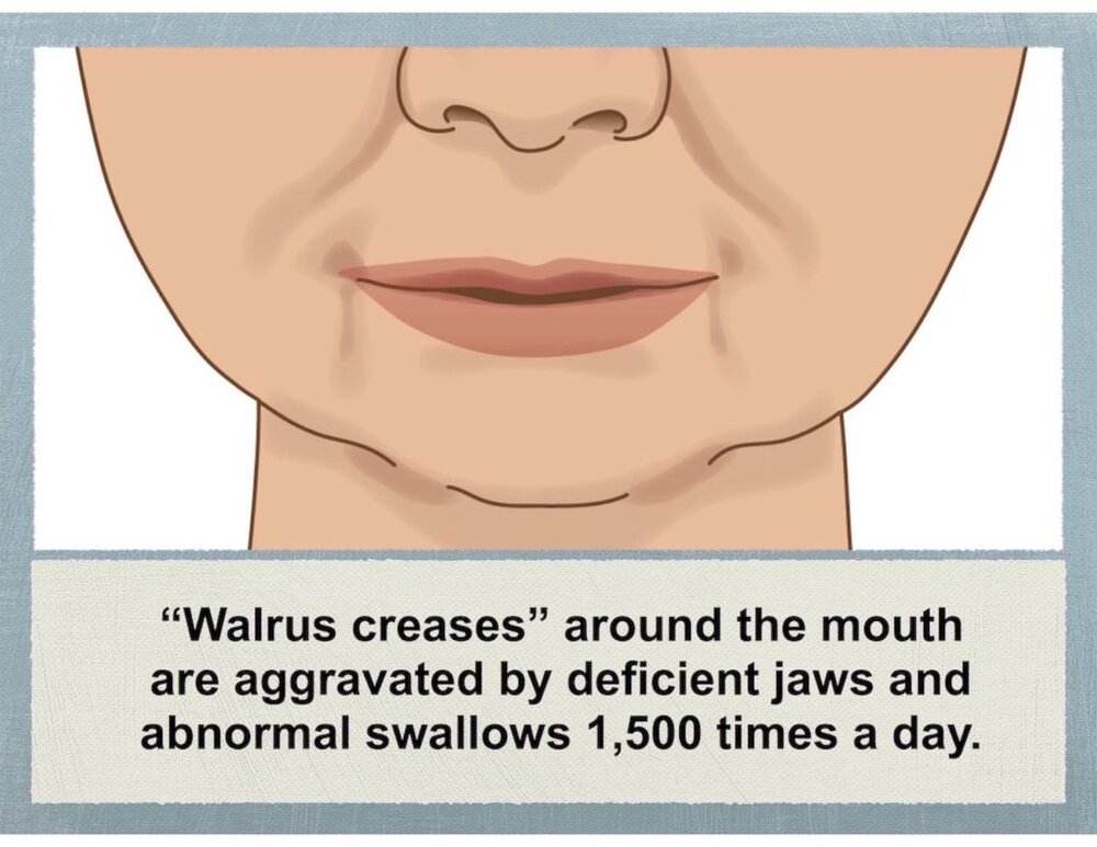 Walrus creases 1024x791