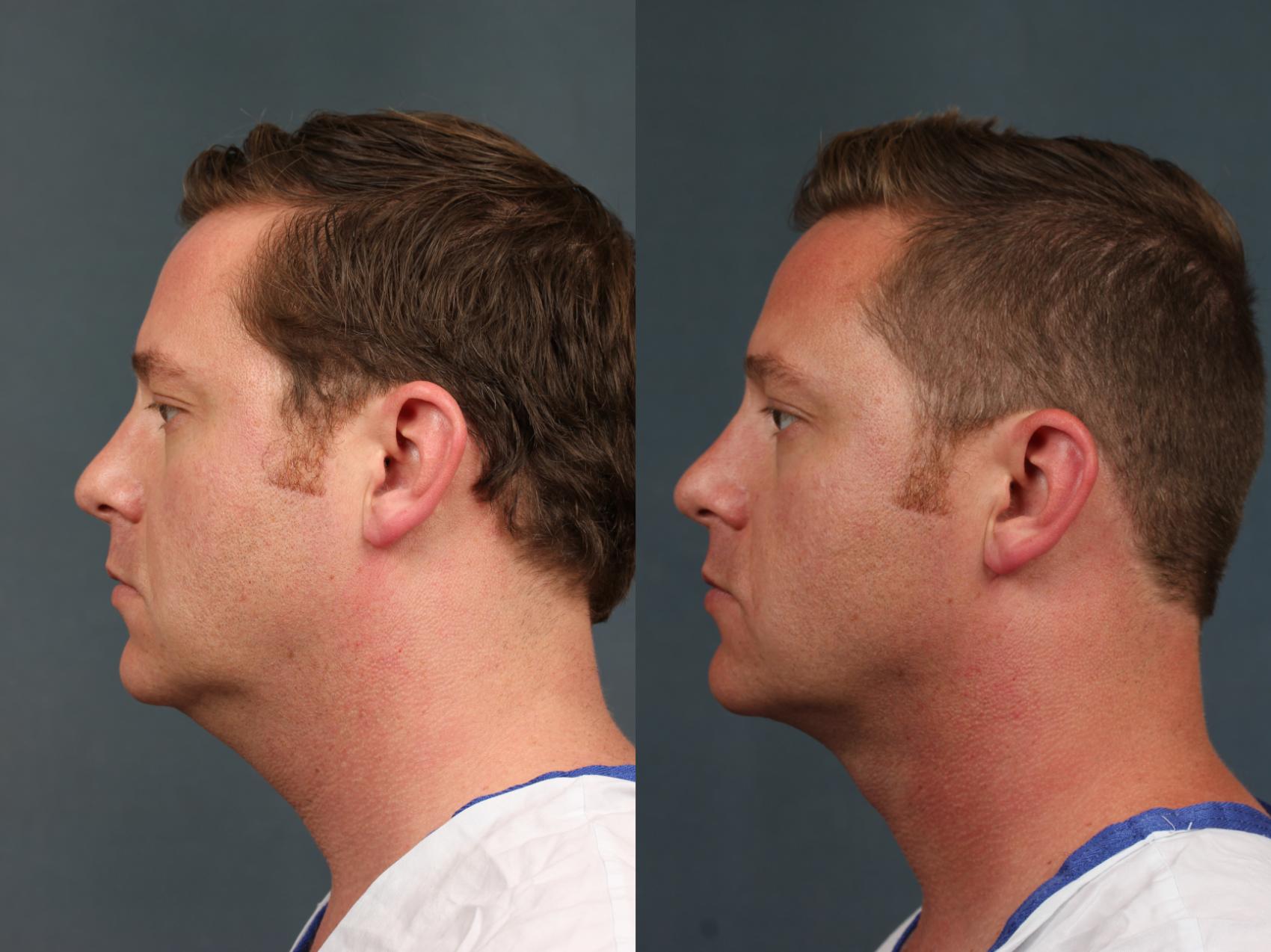 neck-procedures-726-left-side-detail.jpg