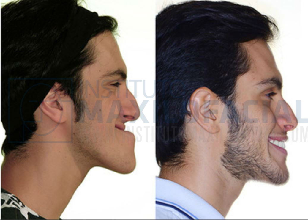perfil-marca-de-agua-2.jpg