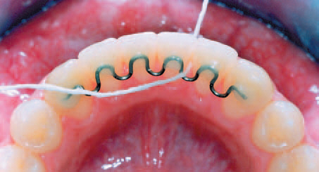 V%20Loop%2011.jpg