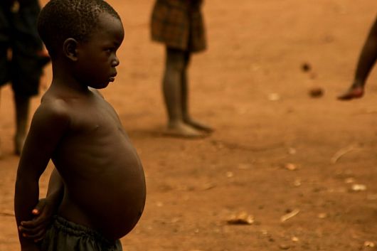 malnourished_people.jpg