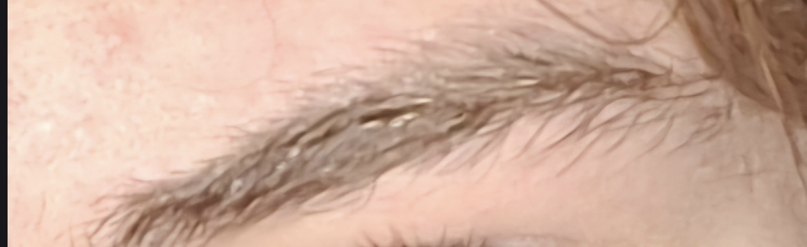 IMG 2241