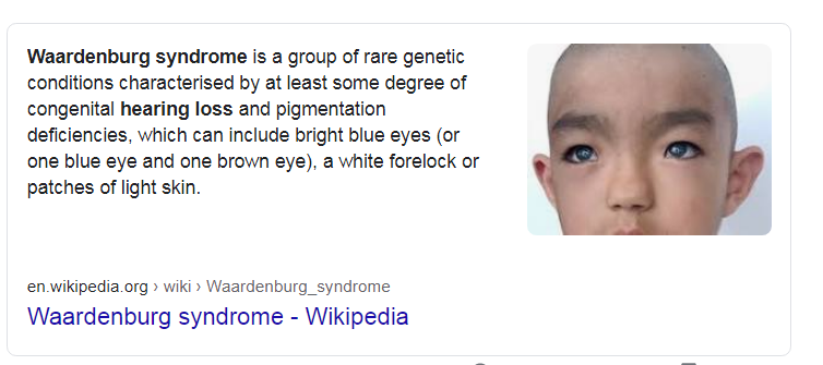 b3ea881d0eed60b09fe4fa4d110d1f9f.png