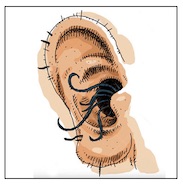 Ear-cartoon-Image.jpg