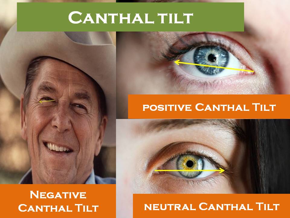 Canthal-Tilt.jpg