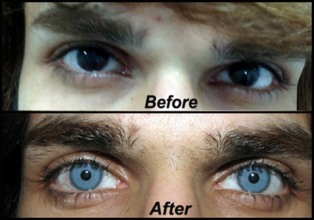 bright-ocular.jpg