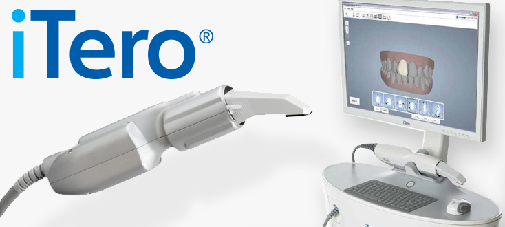 digital-dentistry-itero-scanner.jpg