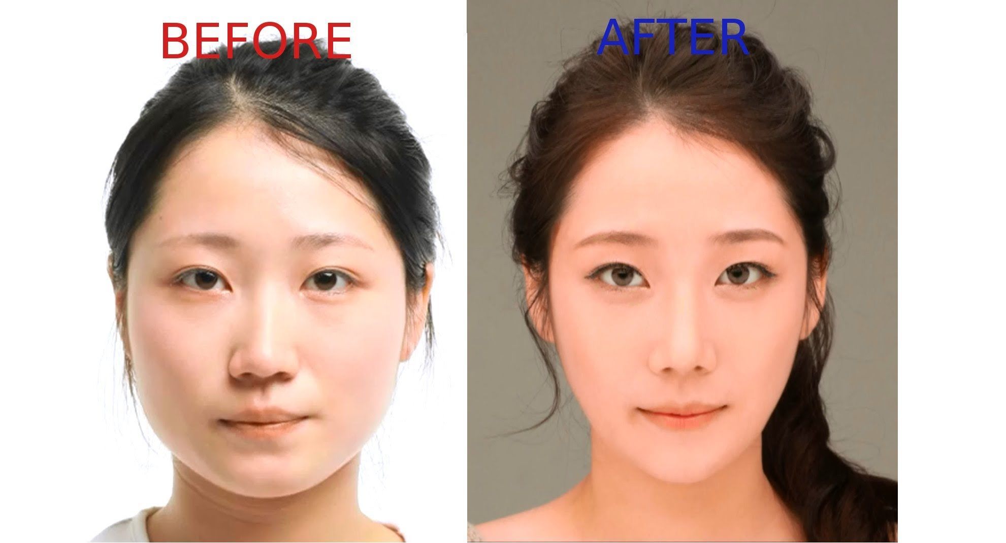 seoulcosmeticsurgery.com
