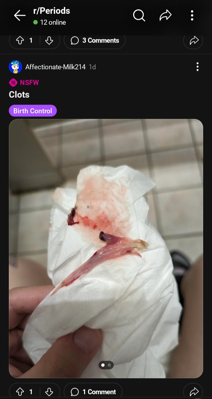 Screenshot 20240504 093508 Reddit