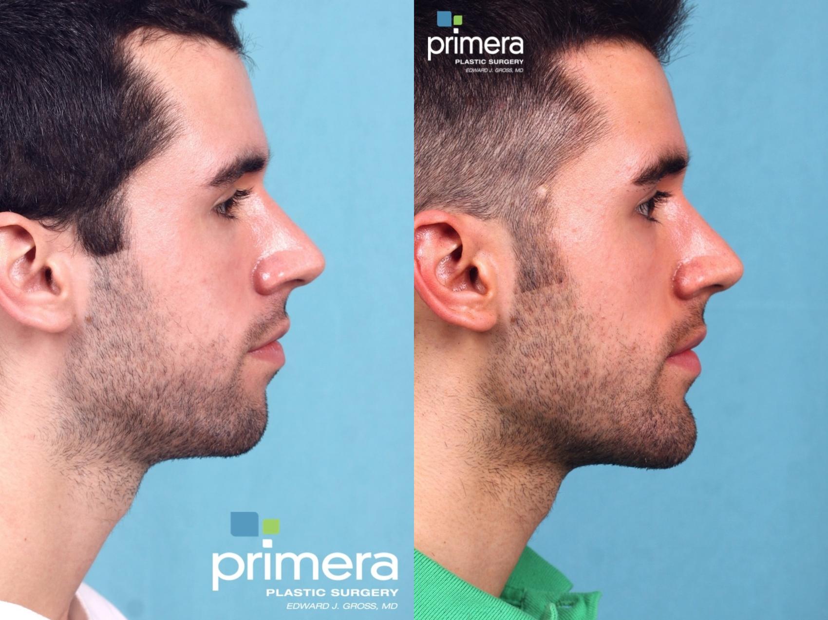 surgery-for-men-361-view1-detail.jpg