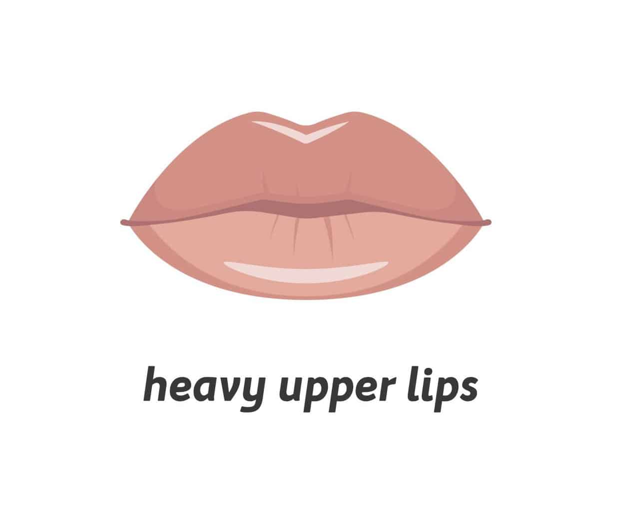 heavy-upper-lip-1536x1274.jpeg