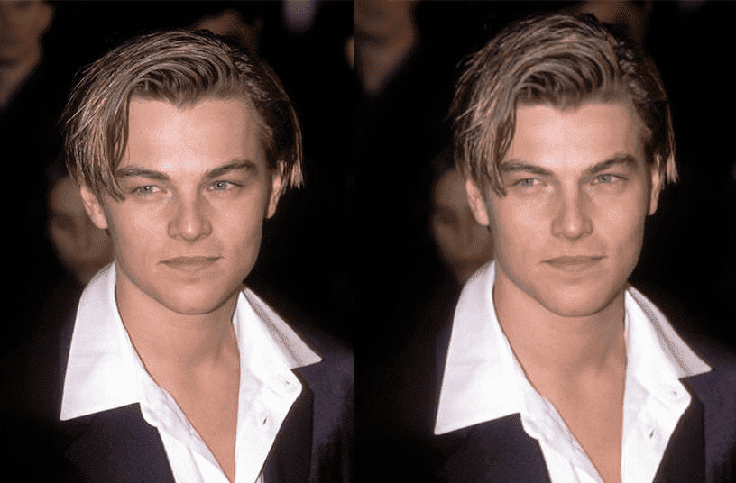 3409659_midface_comparison.png