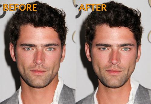 NECK Training 101 - Neck Training changed my life - BEFORE / AFTER |  Looksmax.org - Men's Self-Improvement & Aesthetics