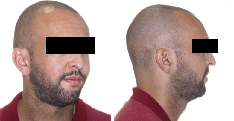 pVOxwmp.jpg