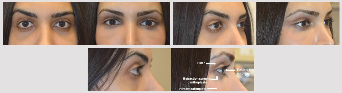 shayan-before-and-after-1.jpg