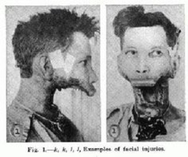 The Jawless Man. My name is Mia Lanes and i'll tell you… | by Mirella C.  Santos | Medium