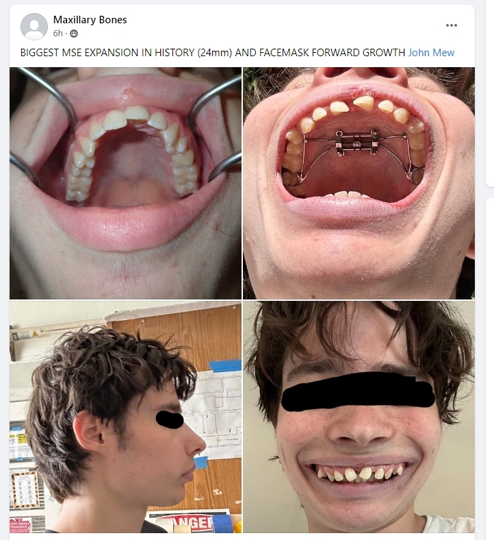 87d77746f3d24a232d1ea7d1724cfd16.jpg