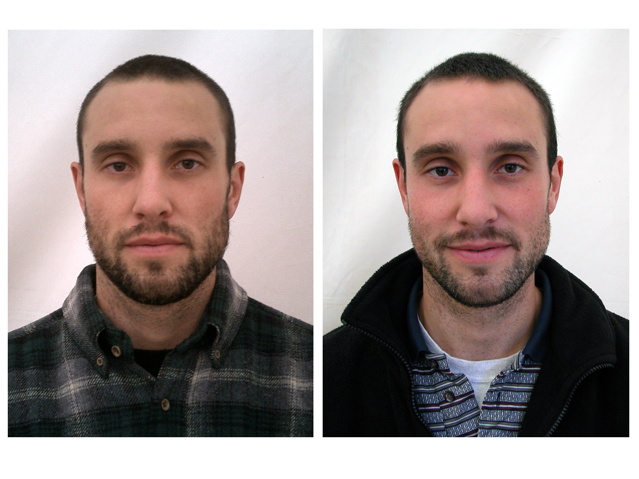 06beforeafterF.jpg