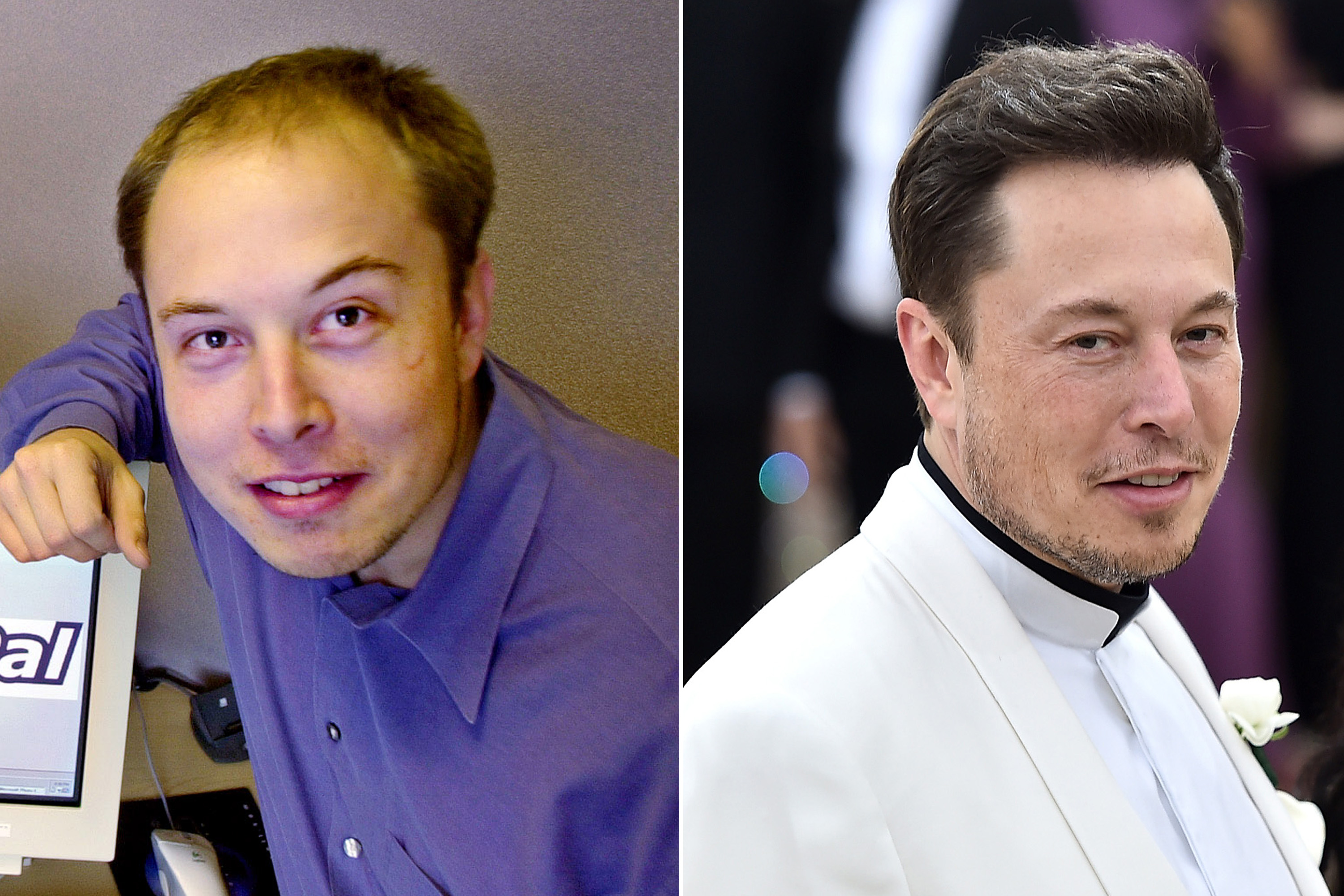 It's 'highly likely' Elon Musk spent over $20K on hair transplant surgery,  doctor says