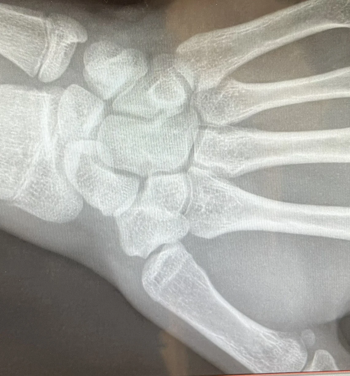 6665037_wrist_1.webp