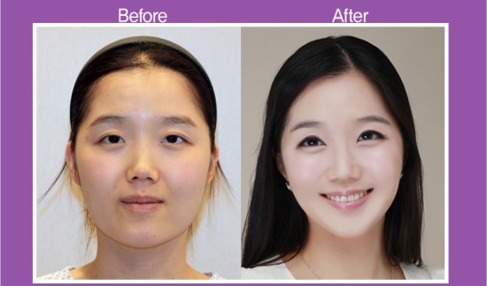 south-korean-cosmetic-surgery.jpg