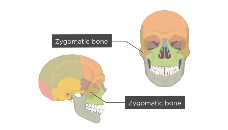 Zygomatic-Bone-Overview-Colored-770x440.png