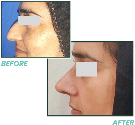 cosmeticoplasty.com