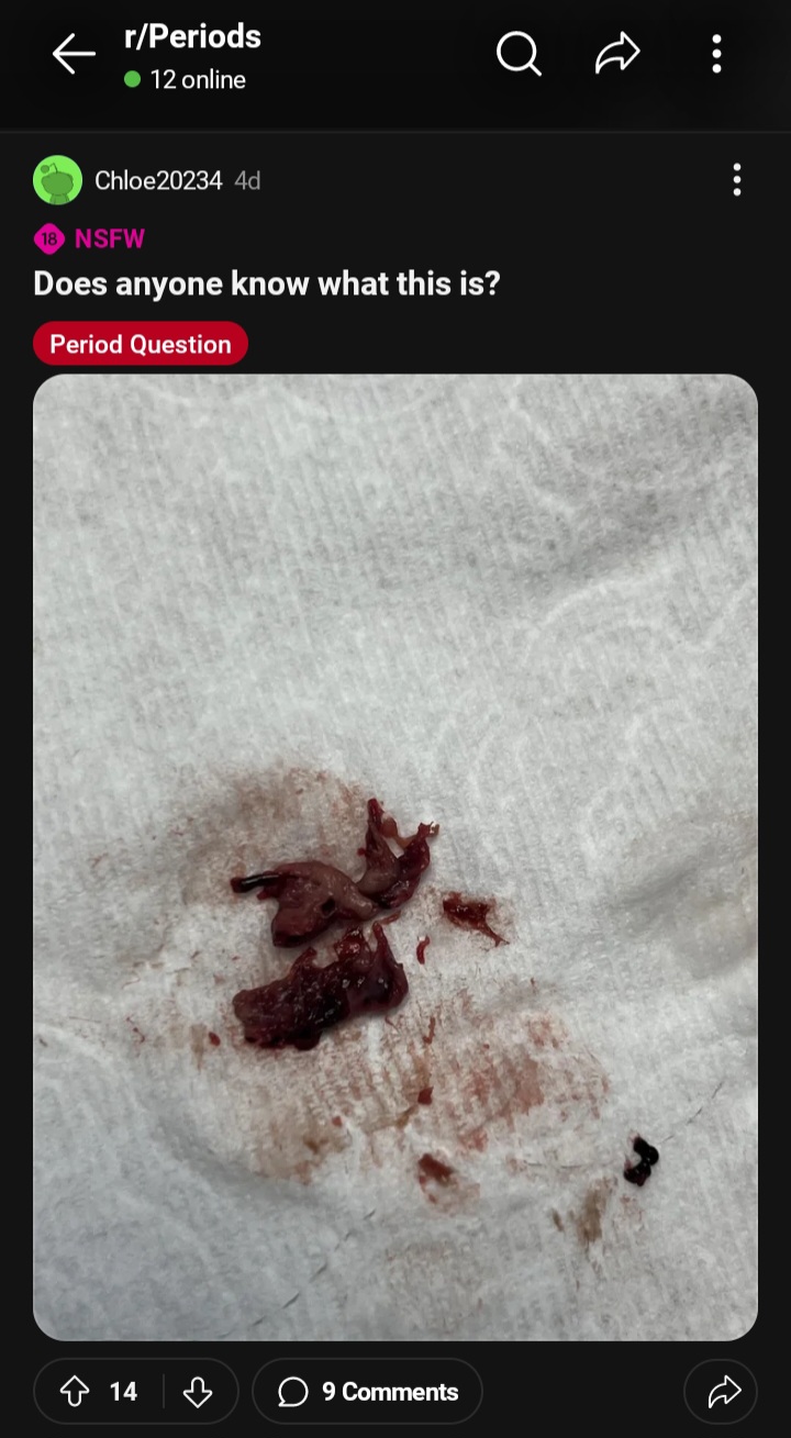 Screenshot 20240504 094013 Reddit