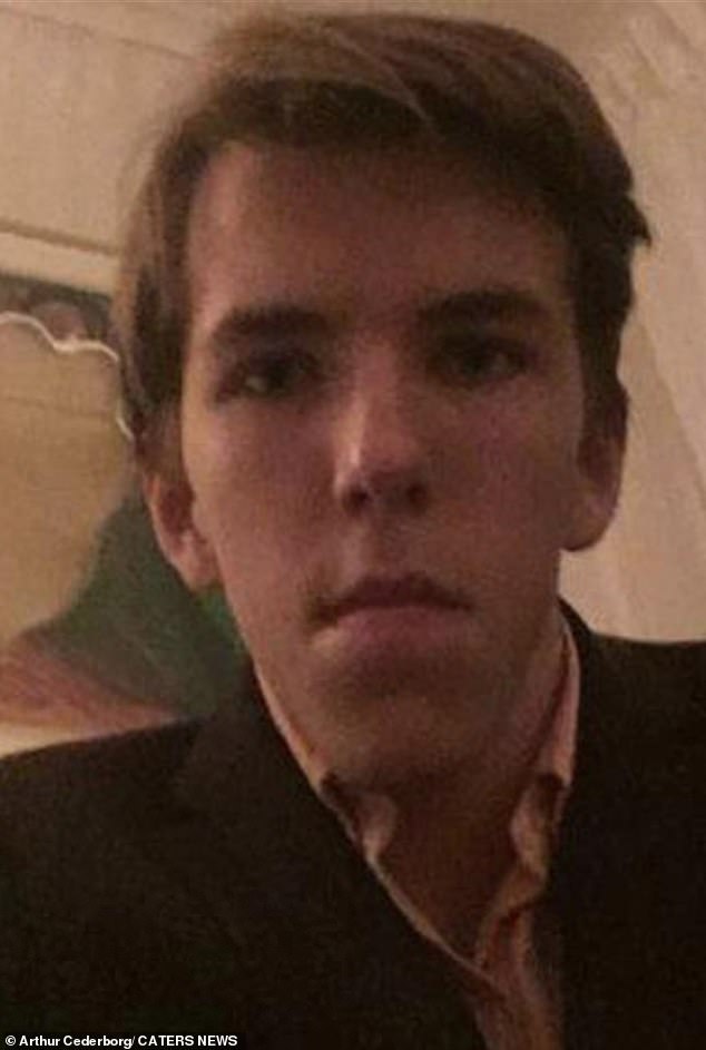 Culinary student, 20, with severe underbite reveals incredible  transformation | Daily Mail Online