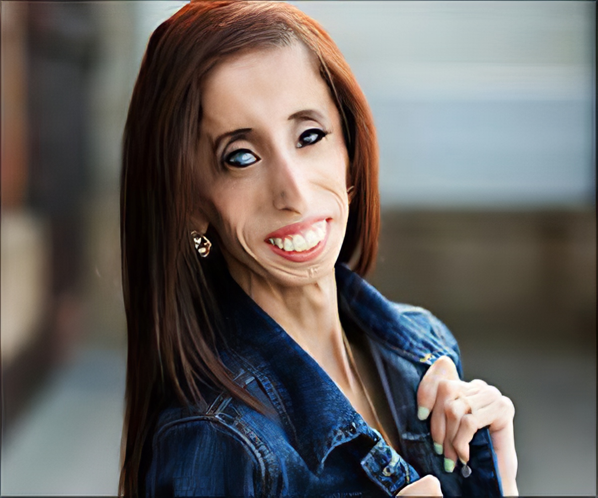 lizzie-velasquez.jpg