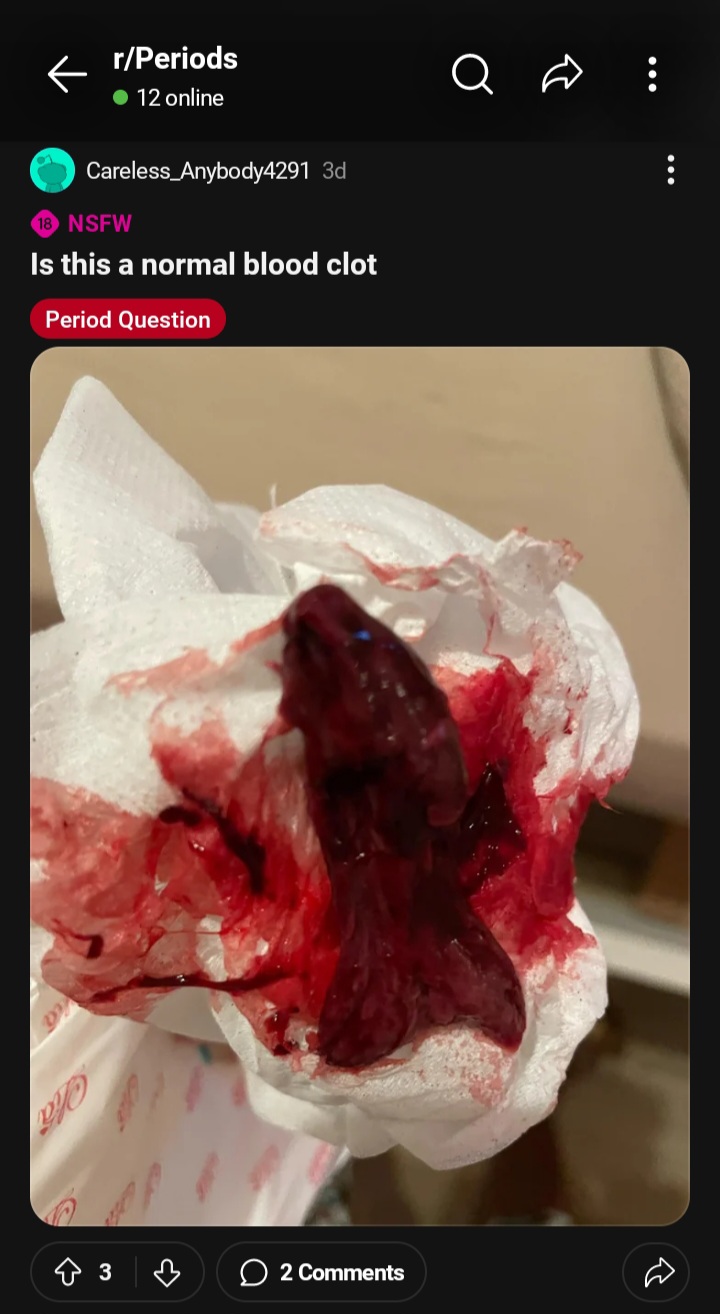 Screenshot 20240504 094001 Reddit