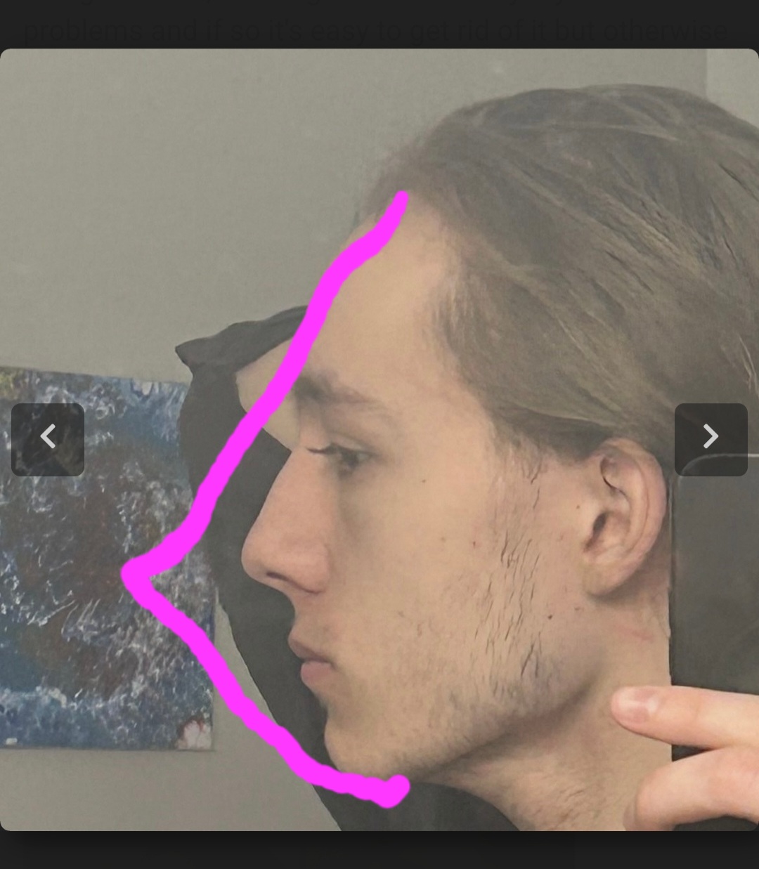 b9x0ssW.jpg