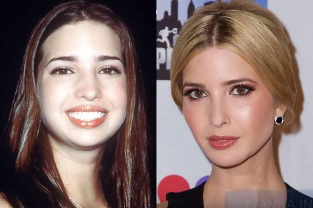 Ivanka-Plastic-Surgery-Rumors.jpg