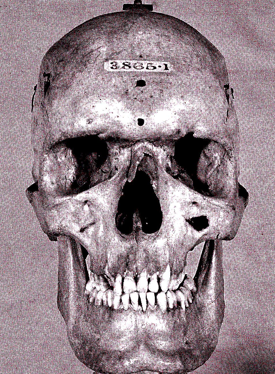 http://freecharlesbyrne.com/images/SKULL2.jpg
